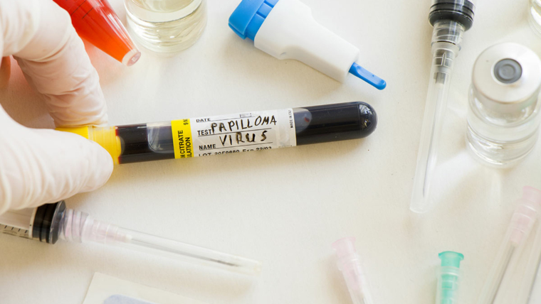 Everything You Need to Know About Human Papillomavirus