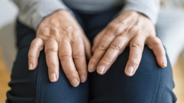 Hormonal Factors Linked to Early Onset of Rheumatoid Arthritis in Women