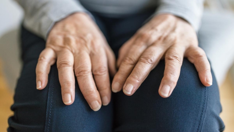 Hormonal Factors Linked to Early Onset of Rheumatoid Arthritis in Women