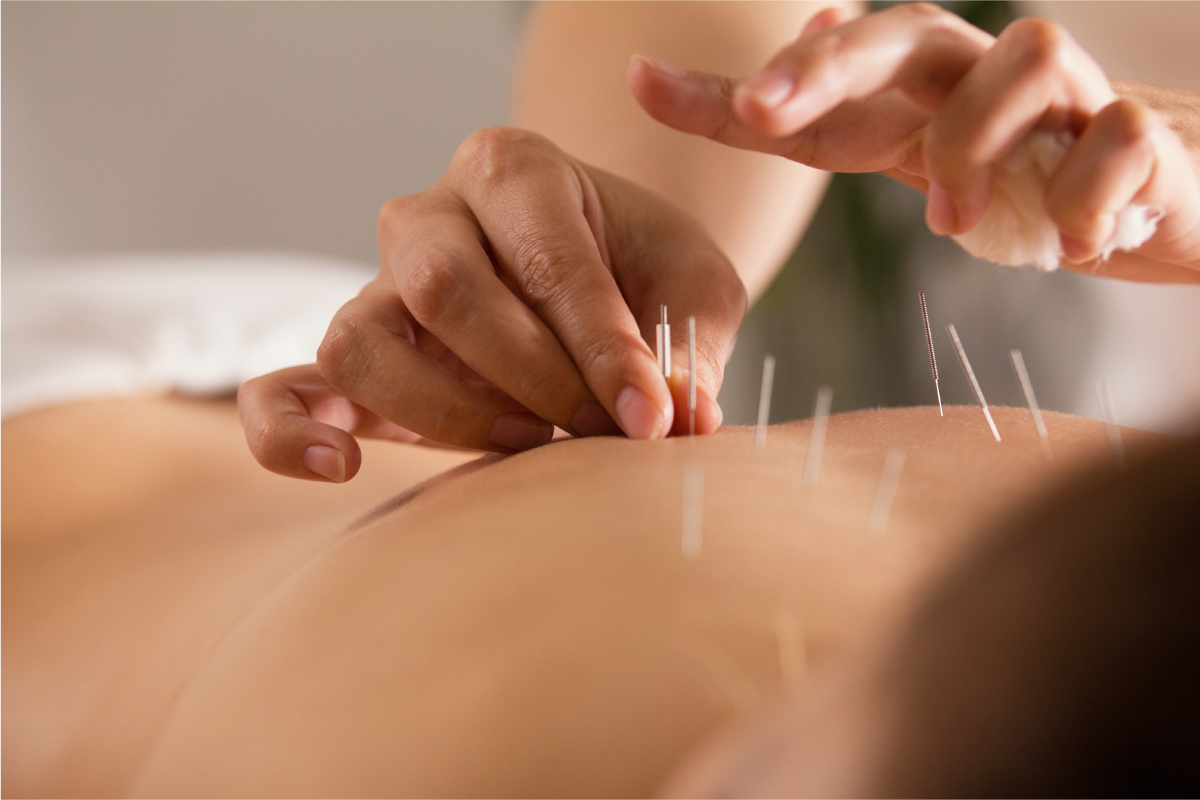 Acupuncture and Its Potential Role in Mainstream Care